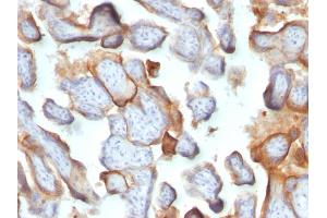 Formalin-fixed, paraffin-embedded human Placenta stained with hCG beta Monoclonal Antibody (SPM105).
