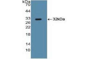Detection of Recombinant Smad5, Human using Polyclonal Antibody to SMAD family member 5 (SMAD5) (SMAD5 Antikörper  (AA 210-464))