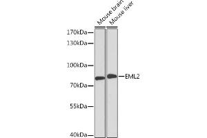 Western blot analysis of extracts of various cell lines, using EML2 Rabbit pAb (ABIN6127842, ABIN6140161, ABIN6140163 and ABIN6218510) at 1:3000 dilution. (EML2 Antikörper  (AA 150-415))
