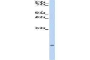 Western Blotting (WB) image for anti-Chemokine (C-C Motif) Ligand 13 (CCL13) antibody (ABIN2463694)