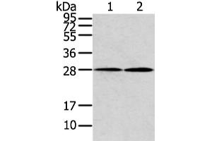 Western Blotting (WB) image for anti-Potassium Large Conductance Calcium-Activated Channel, Subfamily M, beta Member 1 (KCNMB1) antibody (ABIN5958468) (KCNMB1 Antikörper)