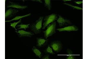 Immunofluorescence of purified MaxPab antibody to LGALS1 on HeLa cell. (LGALS1/Galectin 1 Antikörper  (AA 1-135))
