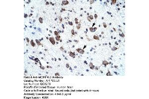 Rabbit Anti-MORF4L2 Antibody       Paraffin Embedded Tissue:  Human neural cell   Cellular Data:  Epithelial cells of renal tubule  Antibody Concentration:   4. (MORF4L2 Antikörper  (N-Term))
