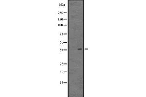 Western blot analysis of GPR81 expression in 293 cell line lysate ;,The lane on the left is treated with the antigen-specific peptide.