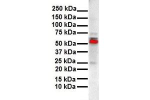 WB Suggested Anti-ESR2 antibody Titration: 1 ug/mL Sample Type: Human liver (ESR2 Antikörper  (N-Term))