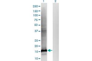 Western Blot analysis of WDHD1 expression in transfected 293T cell line by WDHD1 monoclonal antibody (M01), clone 2F10. (WDHD1 Antikörper  (AA 1031-1128))