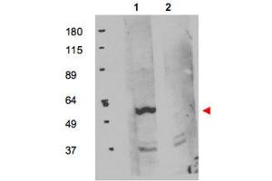 Western blot using FKBP8 polyclonal antibody  shows detection of exogenous FKBP8 in 50 ug of HEK293T whole cell lysate (Lane 1).