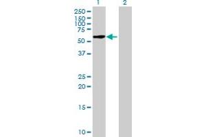 Western Blot analysis of FBXO33 expression in transfected 293T cell line by FBXO33 MaxPab polyclonal antibody. (FBXO33 Antikörper  (AA 1-555))