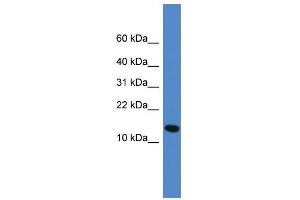 WB Suggested Anti-UFM1 Antibody Titration: 0. (UFM1 Antikörper  (Middle Region))