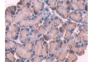 Immunohistochemistry (IHC) image for anti-Cytochrome P450, Family 1, Subfamily A, Polypeptide 1 (CYP1A1) (AA 251-521) antibody (ABIN7441016)