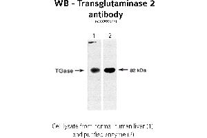 Image no. 1 for anti-Transglutaminase 2 (C Polypeptide, Protein-Glutamine-gamma-Glutamyltransferase) (TGM2) antibody (ABIN346957) (Transglutaminase 2 Antikörper)