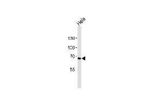 Western blot analysis of lysate from Hela cell line, using TNFRSF8 Antibody (N-term) (ABIN6242779 and ABIN6577598).