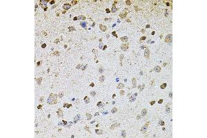 Immunohistochemistry of paraffin-embedded mouse brain using ALDH1A1 antibody. (ALDH1A1 Antikörper  (AA 48-147))