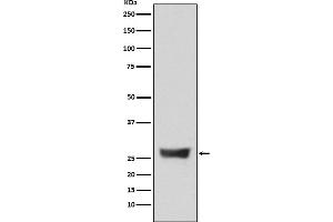 Western Blotting (WB) image for anti-NADH Dehydrogenase (Ubiquinone) Fe-S Protein 3, 30kDa (NADH-Coenzyme Q Reductase) (NDUFS3) antibody (ABIN7606982)