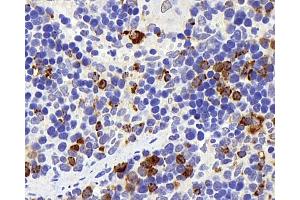 Immunohistochemistry analysis of parafffin-embedded rat spleen using Lysozyme Polyclonal Antibody at dilution of 1:400. (LYZ Antikörper)