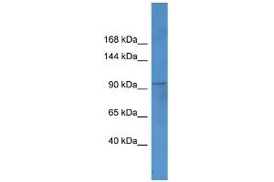 WB Suggested Anti-Ftsj3 Antibody Titration:  0. (FTSJ3 Antikörper  (C-Term))