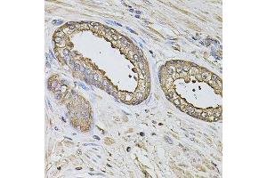 Immunohistochemistry of paraffin-embedded human prostate using S100A12 antibody. (S100A12 Antikörper  (AA 1-92))