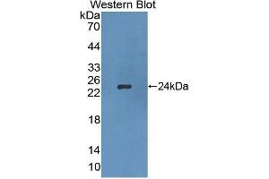 Detection of Recombinant APOB, Rat using Polyclonal Antibody to Apolipoprotein B (APOB) (APOB Antikörper  (AA 2747-2913))