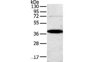 Western blot analysis of A375 cell, using SPARC Polyclonal Antibody at dilution of 1:500 (SPARC Antikörper)