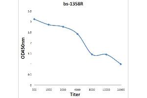 Antigen: 0. (XRCC5 Antikörper  (AA 301-450))