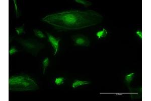 Immunofluorescence of monoclonal antibody to TRIM17 on HeLa cell. (TRIM17 / RNF16 Antikörper  (AA 75-184))