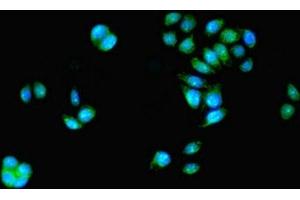Immunofluorescent analysis of PC-3 cells using ABIN7155274 at dilution of 1:100 and Alexa Fluor 488-congugated AffiniPure Goat Anti-Rabbit IgG(H+L) (KAT5 Antikörper  (AA 3-512))