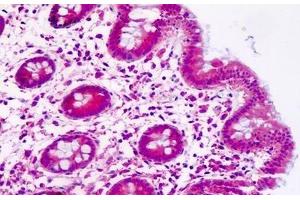 anti-Peptidylprolyl Isomerase C (Cyclophilin C) (PPIC) antibody