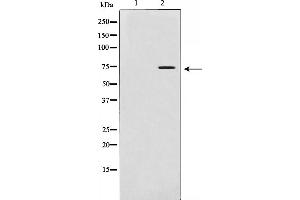 Western blot analysis of MMP 2 expression in LOVO cells. (MMP2 Antikörper)