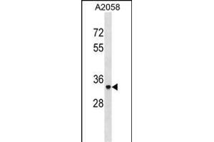 ACP5 Antibody (N-term) (ABIN1881042 and ABIN2838928) western blot analysis in  cell line lysates (35 μg/lane).