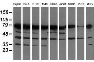 Western blot analysis of extracts (35 µg) from 9 different cell lines by using anti-PUS7 monoclonal antibody.