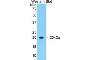 Western blot analysis of the recombinant protein. (ALOX5 Antikörper  (AA 374-536))