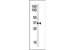 SET7 Antikörper  (C-Term)