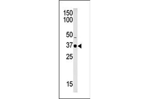 SET7 Antikörper  (C-Term)