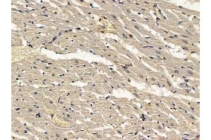 ABIN7094352 and ABIN7098399 at 1/100 staining rat heart tissue by IHC-P. (MEIS2 Antikörper  (C-Term))