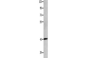 Western Blotting (WB) image for anti-Melanoma Antigen Family B, 4 (MAGEB4) antibody (ABIN2421819) (MAGEB4 Antikörper)