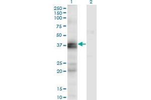 Endothelin-1 Receptor Antikörper  (AA 18-80)