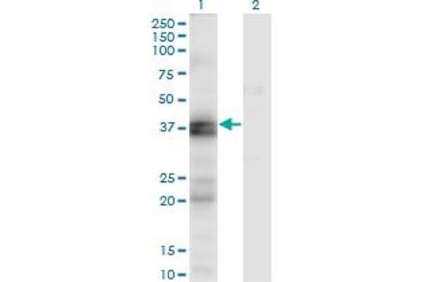 Endothelin-1 Receptor Antikörper  (AA 18-80)