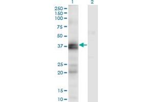 Western Blot analysis of EDNRA expression in transfected 293T cell line by EDNRA monoclonal antibody (M02), clone 2A5. (Endothelin-1 Receptor Antikörper  (AA 18-80))