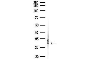anti-Centromere Protein H (CENPH) (N-Term) antibody