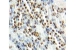 Used in DAB staining on fromalin fixed paraffin-embedded Kidney tissue (MAPK7 Antikörper  (AA 560-793))