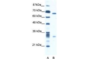 WB Suggested Anti-ASH2L Antibody   Titration: 2. (ASH2L Antikörper  (N-Term))