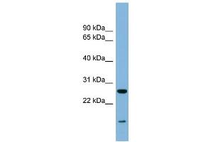 WB Suggested Anti-TRAPPC4 Antibody Titration: 0. (TRAPPC4 Antikörper  (Middle Region))