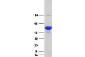 PRKAR1B Protein (Transcript Variant 1) (Myc-DYKDDDDK Tag)