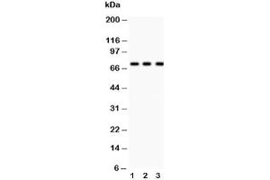Western Blotting (WB) image for anti-Tumor Protein P73 (TP73) (AA 1-198) antibody (ABIN3029401)