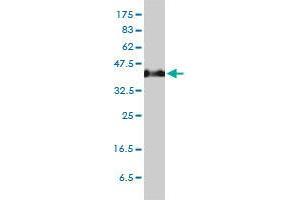 Image no. 1 for anti-Serpin Family H Member 1 (SERPINH1) (AA 1-419) antibody (ABIN465945) (SERPINH1 Antikörper  (AA 1-419))