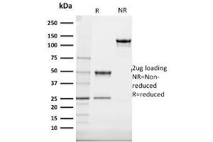 SDS-PAGE Analysis Purified Cytokeratin 20 (KRT20) Mouse Monoclonal Antibody (SPM140). (KRT20 Antikörper  (AA 196-323))