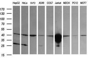 Image no. 2 for anti-T-cell surface glycoprotein CD1c (CD1C) antibody (ABIN1497192) (CD1c Antikörper)
