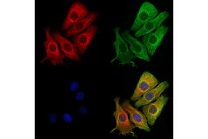 ABIN6261169 and ABIN6273038 staining Hela cells by IF/ICC.