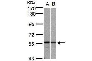 WB Image Sample (30μg whole cell lysate) A:H1299 B:MOLT4 , 7. (PRP19 Antikörper)