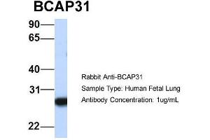 Host:  Rabbit  Target Name:  BCAP31  Sample Type:  Human Fetal Lung  Antibody Dilution:  1. (BCAP31 Antikörper  (Middle Region))